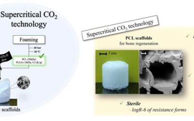 Ready-to-implant bone scaffolds using supercritical fluid technology